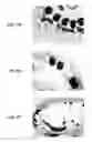 Fig. 18 - Stents having protruding drug-delivery features and associated systems and methods