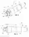 Fig. 05 - Implantable weight control device to promote early and prolonged satiety in a bariatric patient