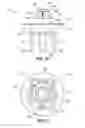 Fig. 09 - Implantable weight control device to promote early and prolonged satiety in a bariatric patient