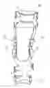 Fig. 01 - Knee joint orthosis