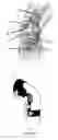 Fig. 02 - Knee joint orthosis