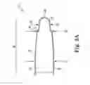 Fig. 05 - Method of implanting a penile prosthetic in a patient