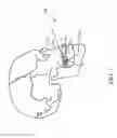 Fig. 04 - System and method for sensor driven intelligent oral appliance