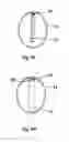 Fig. 11 - INSERTER