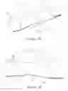 Fig. 04 - Wound dressing apparatus and method of use thereof