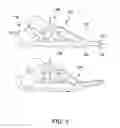 Fig. 02 - Apparatus and method for dynamic foot support
