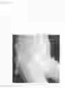 Fig. 09 - Method for manufacturing underpants-type disposable diaper, and underpants-type disposable diaper
