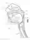 Fig. 02 - Treating sleep apnea with negative pressure