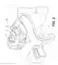 Fig. 03 - Treating sleep apnea with negative pressure