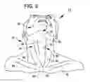 Fig. 04 - Treating sleep apnea with negative pressure
