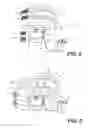 Fig. 06 - Treating sleep apnea with negative pressure
