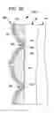 Fig. 16 - Treating sleep apnea with negative pressure