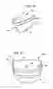 Fig. 22 - Treating sleep apnea with negative pressure