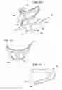 Fig. 23 - Treating sleep apnea with negative pressure