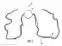 Fig. 02 - Cold foot pain reliever