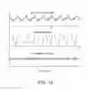 Fig. 15 - Method and apparatus for enhancement of chest compressions during CPR