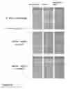 Fig. 14 - Kit and method for detecting porous dental hydroxyapatite