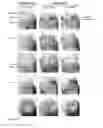 Fig. 15 - Kit and method for detecting porous dental hydroxyapatite
