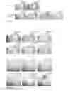 Fig. 16 - Kit and method for detecting porous dental hydroxyapatite