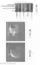 Fig. 07 - CORE-SHELL PARTICLE FORMULATION FOR DELIVERING MULTIPLE THERAPEUTIC AGENTS