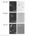 Fig. 32 - Hydrogel compositions comprising encapsulated cells and methods of use thereof
