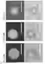 Fig. 46 - Hydrogel compositions comprising encapsulated cells and methods of use thereof