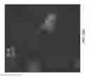Fig. 14 - METHODS AND COMPOSITIONS FOR KILLING SENESCENT CELLS AND FOR TREATING SENESCENCE-ASSOCIATED DISEASES AND DISORDERS