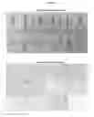 Fig. 05 - INTERMITTENT DOSING OF MDM2 INHIBITOR