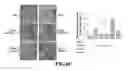 Fig. 11 - Composition comprising GPCR19 agonist as an active ingredient for preventing or treating allergic dermatitis