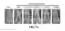 Fig. 12 - Composition comprising GPCR19 agonist as an active ingredient for preventing or treating allergic dermatitis