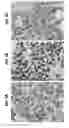 Fig. 08 - Reducing CXCR4 expression and/or function to enhance engraftment of hematopoietic stem cells