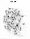 Fig. 10 - Reducing CXCR4 expression and/or function to enhance engraftment of hematopoietic stem cells