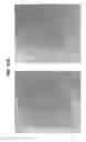 Fig. 28 - Reducing CXCR4 expression and/or function to enhance engraftment of hematopoietic stem cells