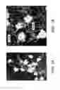 Fig. 02 - Methods for treating and preventing neutrophil-derived net toxicity and thrombosis