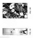 Fig. 06 - Methods for treating and preventing neutrophil-derived net toxicity and thrombosis