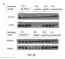 Fig. 06 - Methods, antibodies, and vaccines utilizing epitopes of alpha synuclein for treatment of parkinsons disease