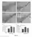 Fig. 14 - Methods, antibodies, and vaccines utilizing epitopes of alpha synuclein for treatment of parkinsons disease