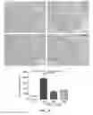 Fig. 15 - Methods, antibodies, and vaccines utilizing epitopes of alpha synuclein for treatment of parkinsons disease