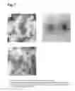 Fig. 08 - Vaccine containing virus-like particles