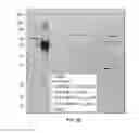 Fig. 11 - Microneedle compositions and methods of using same
