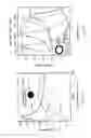 Fig. 02 - METHODS AND SYSTEMS FOR TREATING CELL PROLIFERATION DISORDERS USING PLASMONICS ENHANCED PHOTOSPECTRAL THERAPY (PEPST) AND EXCITON-PLASMON ENHANCED PHOTOTHERAPY (EPEP)
