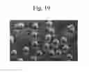 Fig. 20 - METHODS AND SYSTEMS FOR TREATING CELL PROLIFERATION DISORDERS USING PLASMONICS ENHANCED PHOTOSPECTRAL THERAPY (PEPST) AND EXCITON-PLASMON ENHANCED PHOTOTHERAPY (EPEP)