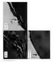 Fig. 04 - METHODS FOR TREATING MULTIPLE SCLEROSIS