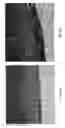Fig. 05 - METHODS FOR TREATING MULTIPLE SCLEROSIS