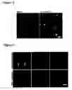Fig. 06 - Optical imaging probes
