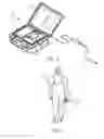 Fig. 06 - Sterilization device and methods