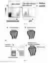 Fig. 05 - METHODS FOR REPAIRING CARTILAGE DAMAGE