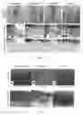 Fig. 06 - METHODS FOR REPAIRING CARTILAGE DAMAGE