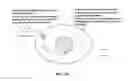 Fig. 07 - METHODS FOR REPAIRING CARTILAGE DAMAGE