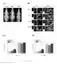 Fig. 20 - Thermosensitive biodegradable hydrogel